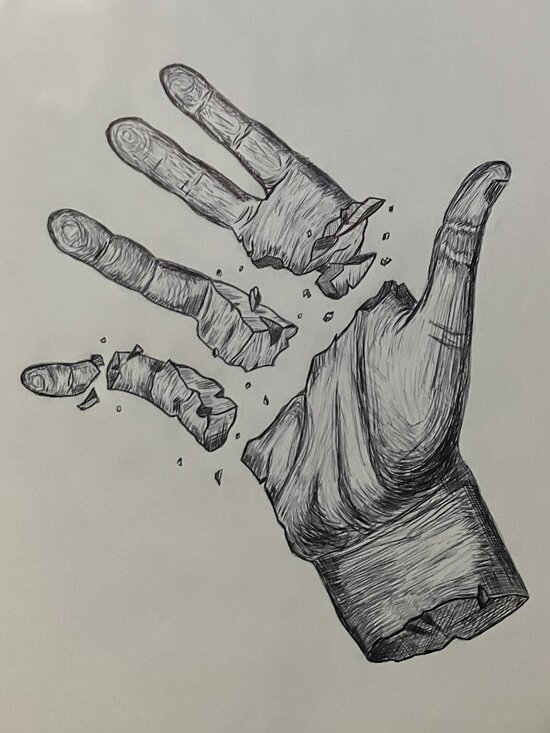 Broken Hand - Picture 1 of 1